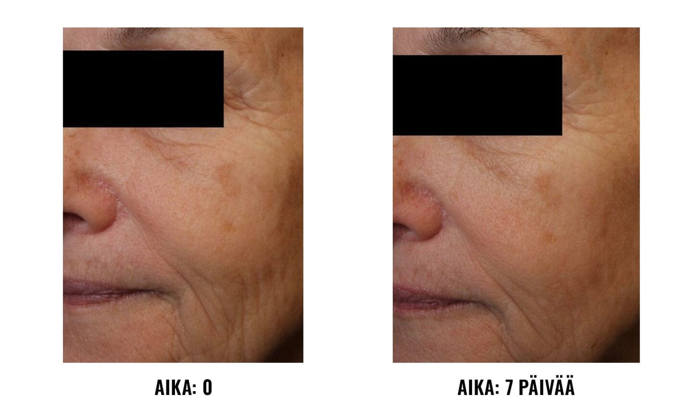 Daily Dynamic Hydrator iS Clinical iS Clinical 