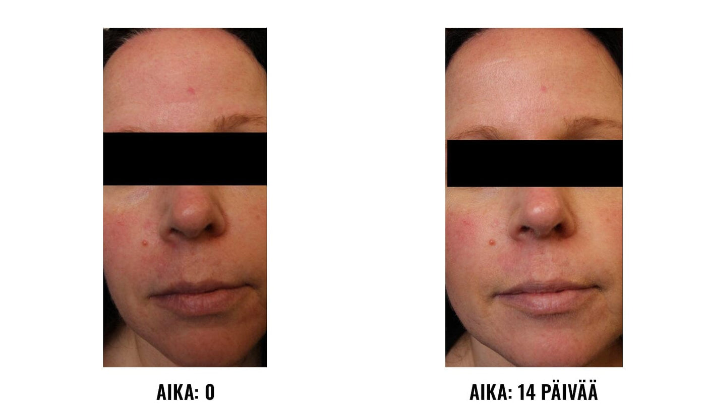 Daily Dynamic Hydrator iS Clinical iS Clinical 